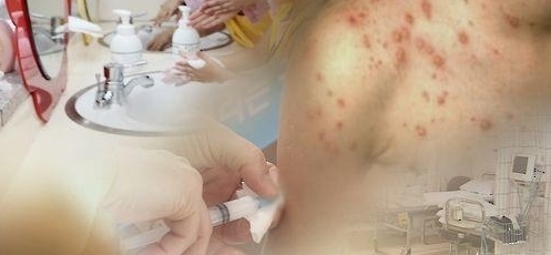 ‘어린이 수두 감염 조심하세요’…11∼12월 기승