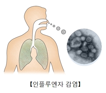 독감 인플루엔자 바이러스로 감염..증상과 예방접종은?